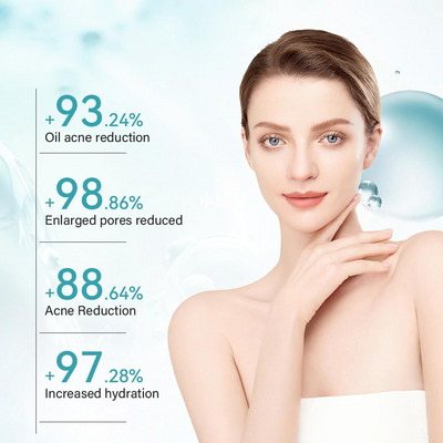 Clevana Oil Control Acne Removal Cream – Adult Acne Treatment with Tea Tree & Salicylic Acid